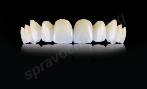 Протезирование зубов в москве, преимущества в ладент