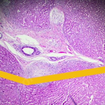 Патологическая анатомия