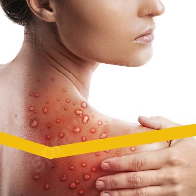 Сестринская помощь больным с кожными и венерич-и заболеваниями