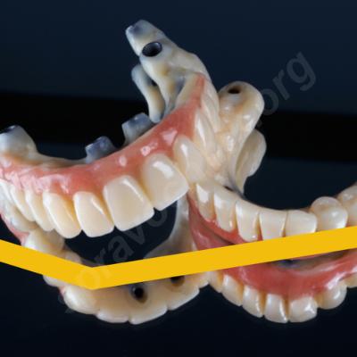 Современные аспекты ортопедической помощи населению